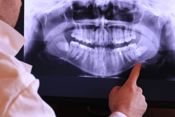 Best Emergency Dental Care for Broken or Chipped Teeth in Garden City Park, NY
